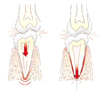 dolor dental